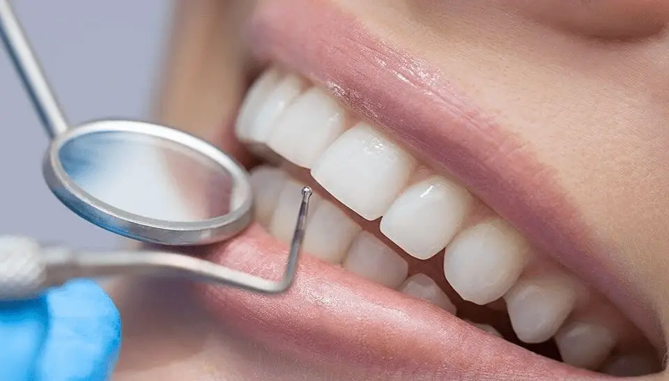 Dental Crowns