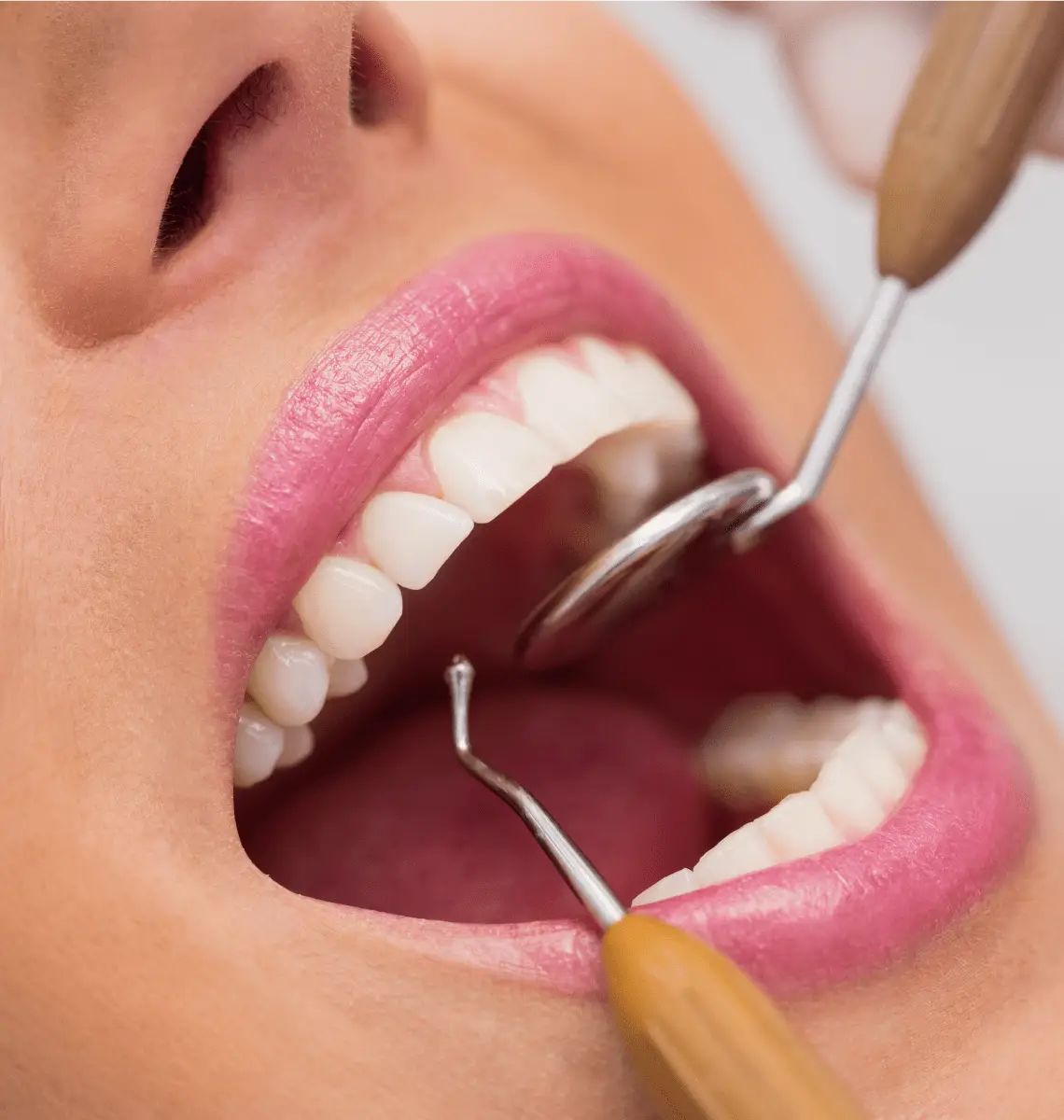 Repairing Broken or Damaged Teeth