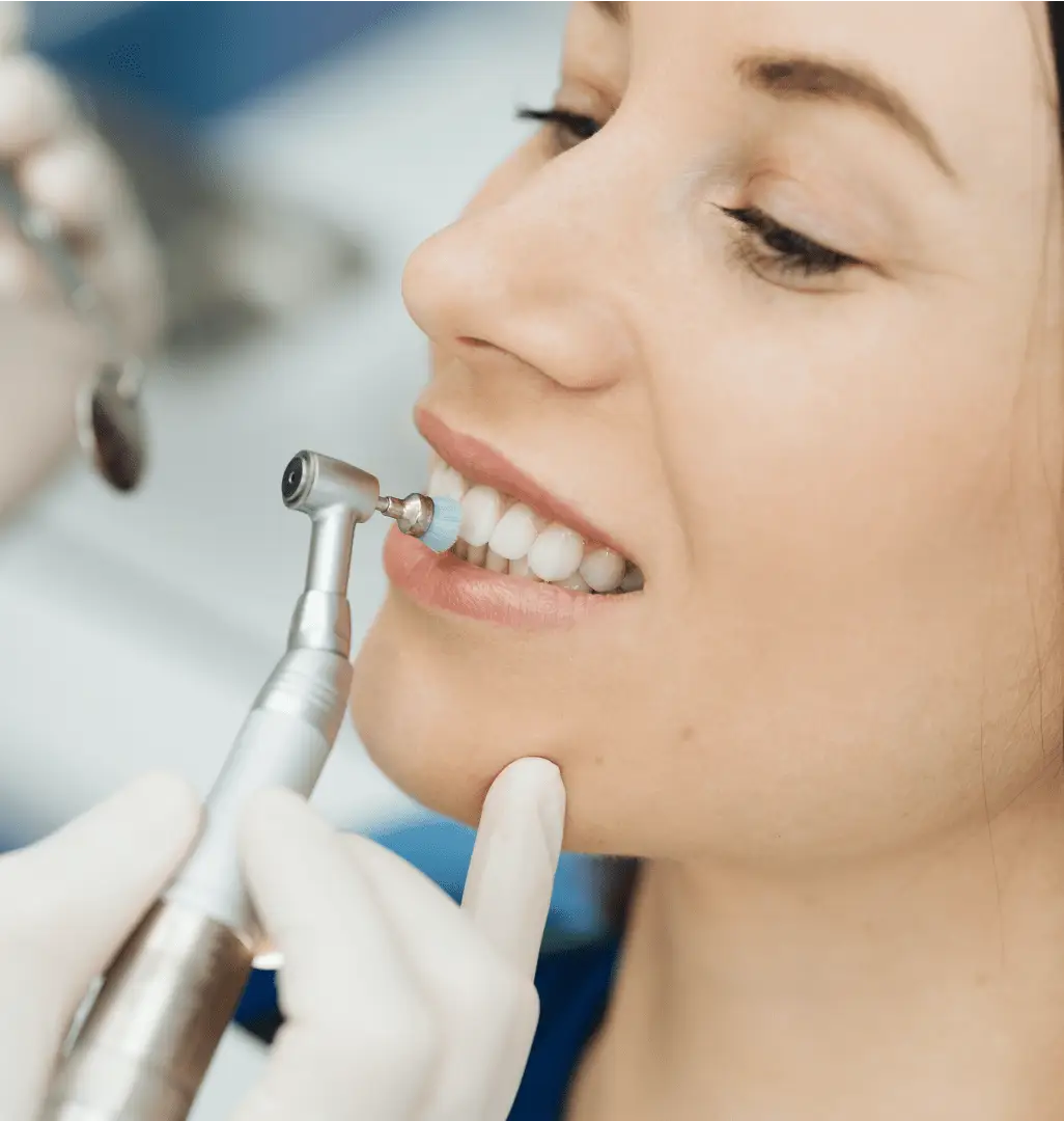 Teeth Whitening