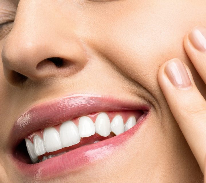 Improve your smile